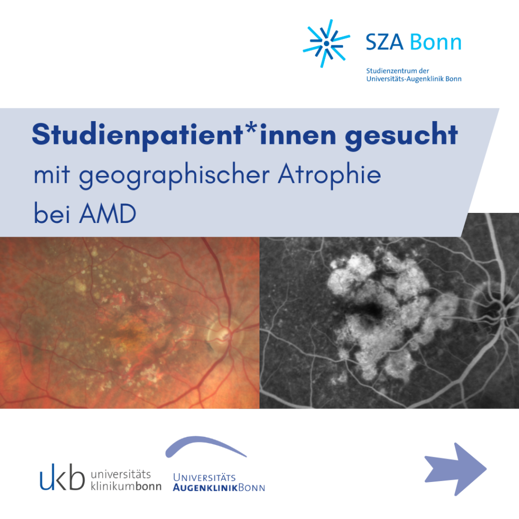 Grafik des Studienzentrums der Universitäts-Augenklinik Bonn zur Rekrutierung von Studienteilnehmerinnen und Studienteilnehmern mit geographischer Atrophie bei altersabhängiger Makuladegeneration (AMD). Die Überschrift lautet „Studienpatient*innen gesucht mit geographischer Atrophie bei AMD“. Darunter sind zwei diagnostische Netzhautaufnahmen abgebildet: links ein Farbfundusfoto mit typischen Veränderungen einer geographischen Atrophie, rechts eine Autofluoreszenzaufnahme mit hellen und dunklen Arealen, die den Gewebeverlust der Netzhaut darstellen. Im unteren Bereich befinden sich die Logos des Universitätsklinikums Bonn und der Universitäts-Augenklinik Bonn sowie ein Pfeilsymbol, das auf weitere Informationen verweist. Die Grafik ist in hellblauen und dunkelblauen Farbtönen gestaltet.
