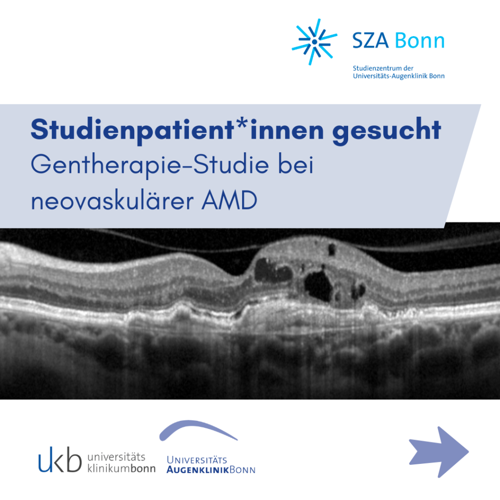 Grafik des Studienzentrums der Universitäts-Augenklinik Bonn zur Rekrutierung von Studienteilnehmerinnen und Studienteilnehmern für eine Gentherapie-Studie bei neovaskulärer altersabhängiger Makuladegeneration (AMD). Im oberen Bereich steht die Überschrift „Studienpatient*innen gesucht – Gentherapie-Studie bei neovaskulärer AMD“. Darunter ist eine schwarz-weiße OCT-Aufnahme der Netzhaut mit typischen Flüssigkeitsansammlungen bei feuchter AMD abgebildet. Im unteren Bereich befinden sich die Logos des Universitätsklinikums Bonn und der Universitäts-Augenklinik Bonn sowie ein Pfeilsymbol, das auf weitere Informationen verweist. Die Grafik verwendet überwiegend hellblaue und dunkelblaue Farbtöne.